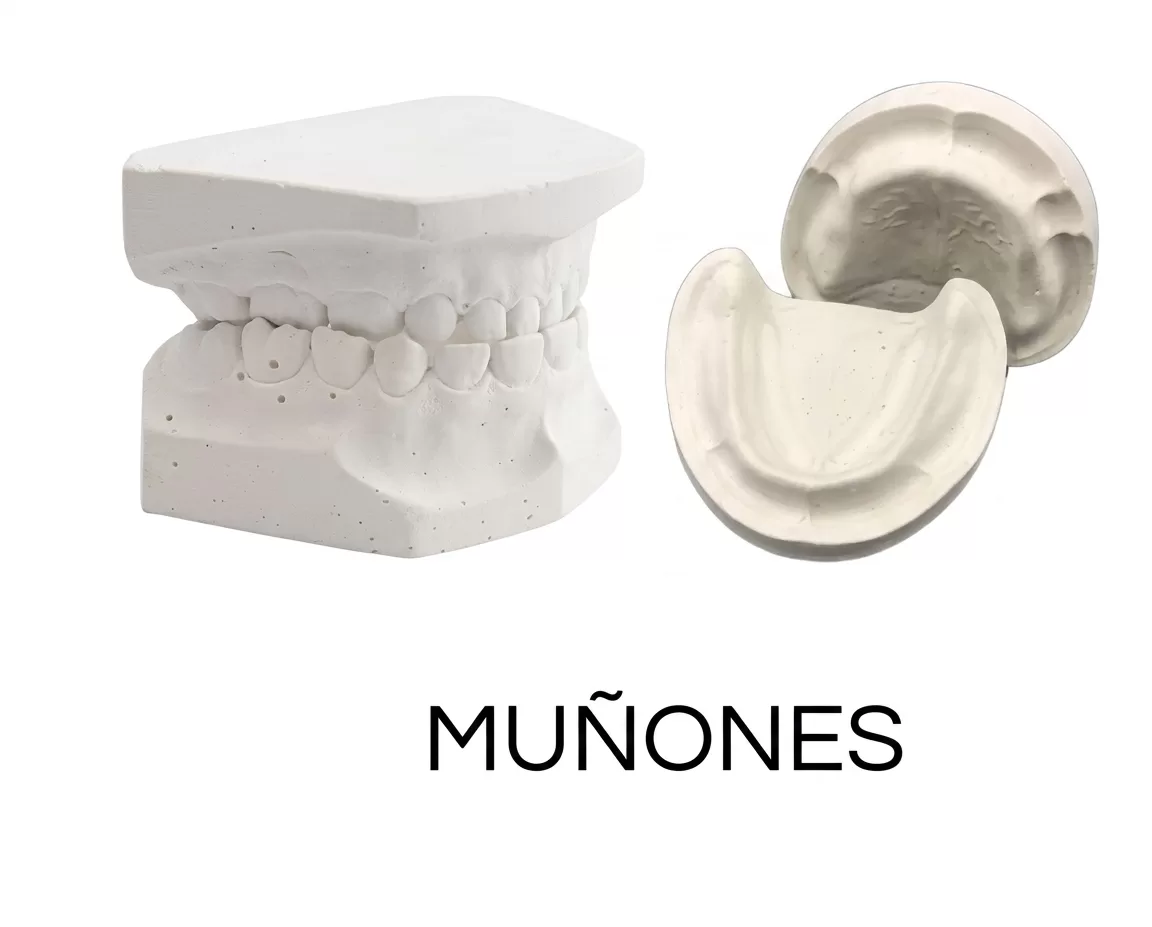 MODELO DE YESO( MUÑONES)